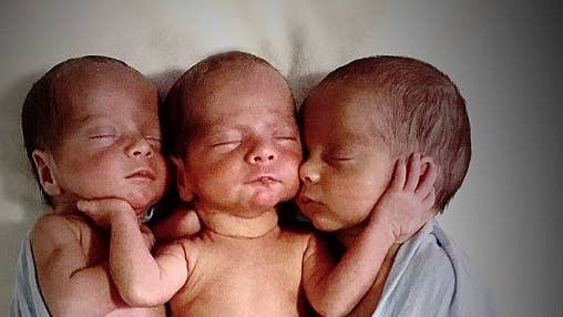 Doctor Freezes When He Sees Faces Of Newborn Triplets, Claims Odds Are 1 In 200 Million