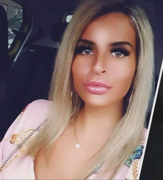 Tattooed Woman Who Keeps Her Nose Inside A Jar Reveals How She Looked tattooed-woman-who-keeps-her-nose-inside-a-jar-reveals-how-she-looked