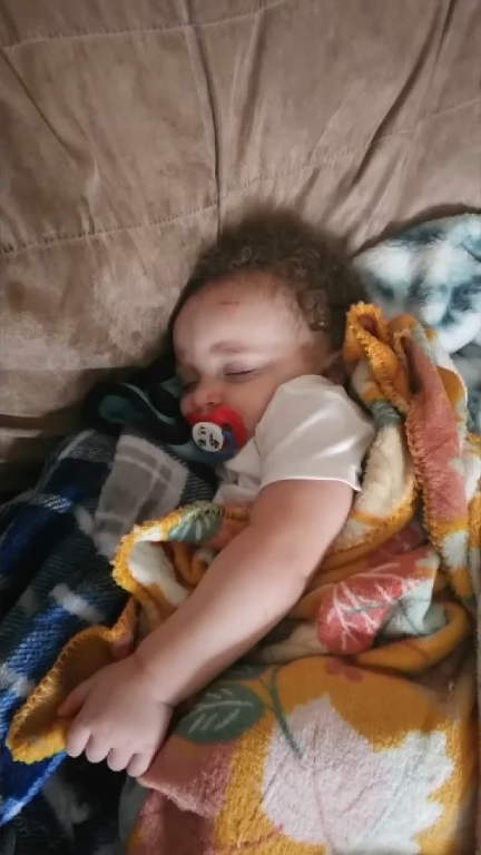 Baby Lord with a scratch wound on his head, sleeping peacefully in a bed, Photo Credit: NBC News