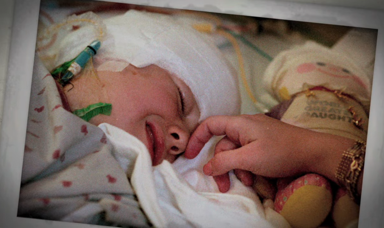 A young Christina Santhouse lying on a hospital bed after her surgery with bandage on her head, Photo Credit: ScientificAmericanPsychology/Youtube