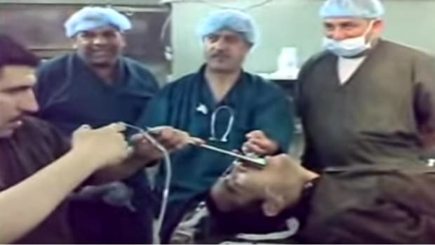 Surgeon Removes Wrench From Man's Throat (Video) Promo Image