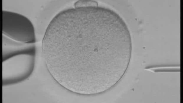 Human Embryos In A Petri Dish.