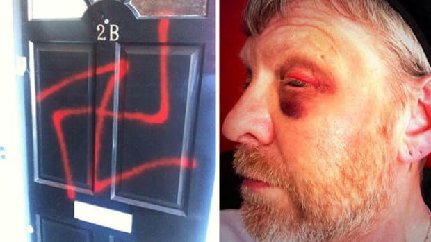 Man Beaten 30 Times In Three Years For Being Jewish Promo Image