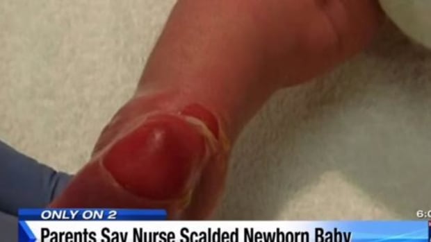 Parents Shocked To See What Happened To Baby's Foot While She Was In Hospital's Care (Photos) Promo Image