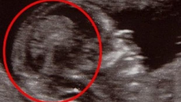 Father Notices Something Unusual In Unborn Daughter's Ultrasound (Photo) Promo Image