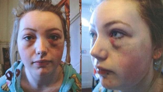 Bullying Victim’s Mother: I’m Not Sorry For What I Did To My Daughter’s Bullies (Photos) Promo Image