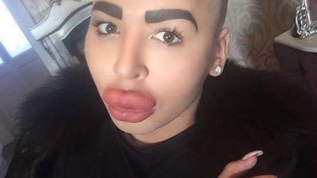 Kim Kardashian Lookalike Needs Repairs To Leaking Lips Promo Image