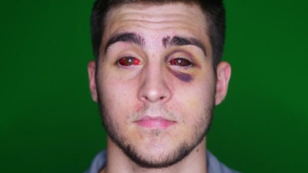 Student: Undercover Cops Beat The Wrong Man (Video) Promo Image