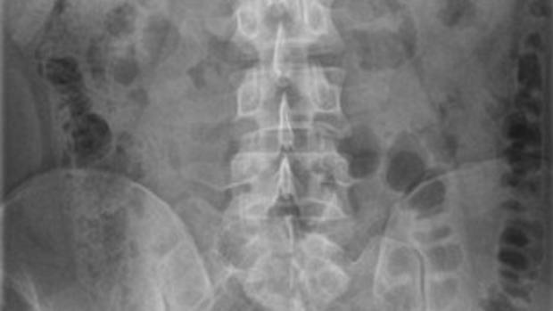 Man Swallows Cellphone (Photo) Promo Image