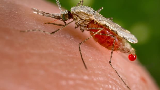 Study: Zika Still Dangerous In 3rd Trimester Of Pregnancy Promo Image