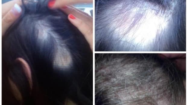FDA Issues Safety Alert For Hair Care Line (Photos) Promo Image