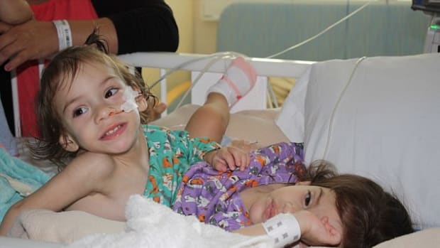 Conjoined Twins Survive Separation Surgery Promo Image