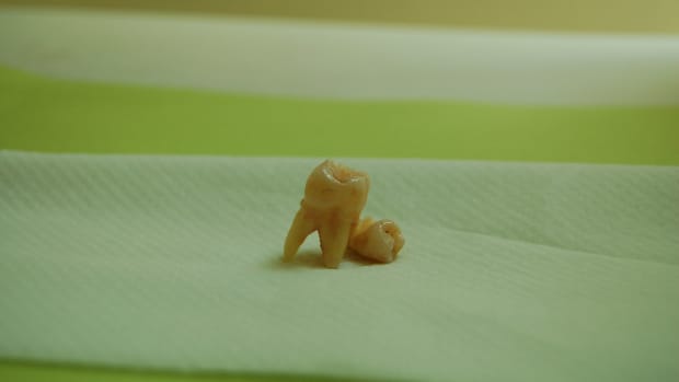 Saving Baby Teeth May Be Beneficial Promo Image