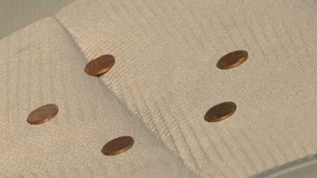 Woman Suffers Third-Degree Burns From Hot Pennies (Photo) Promo Image
