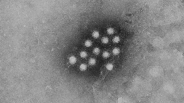Viral Hepatitis Kills More Than TB And HIV Promo Image