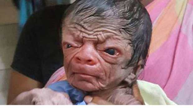 Unusually Hairy Newborn Baby Looks 80 (Video) Promo Image