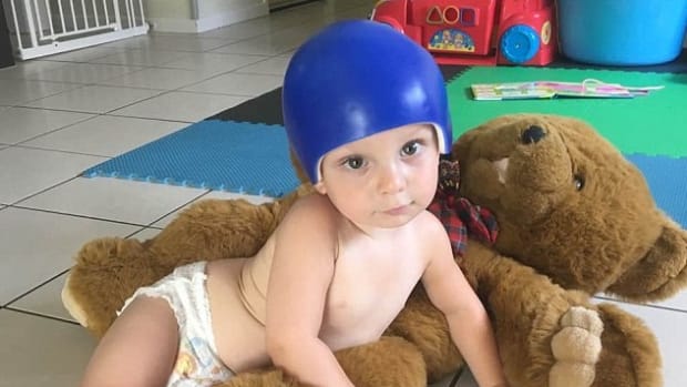 Boy Dies Of Flesh Eating Virus After Falling Off Bike Opposing Views