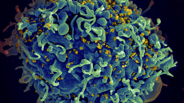 Scientists Discover Potential Cure For HIV Using CRISPR Promo Image