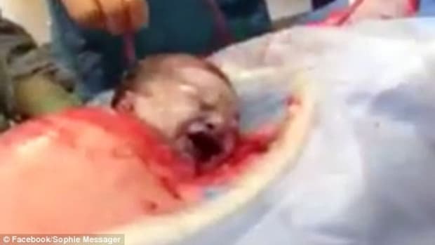 Bizarre Moment Baby Crawls Out Of Mother's Womb (Video) Promo Image
