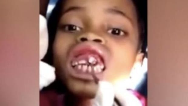 10-Year-Old Goes To Doctor With 'Tingling' In Mouth, Gets Bad News (Video) Promo Image
