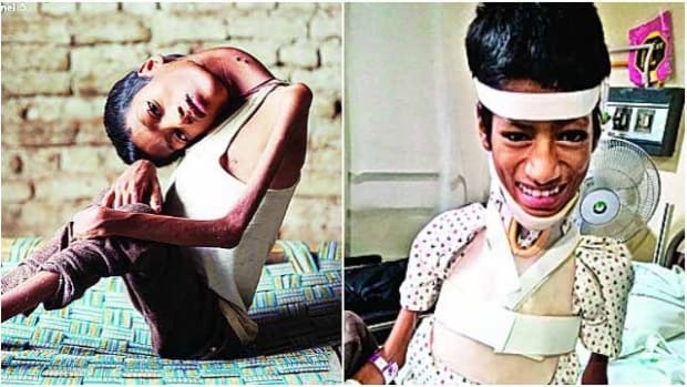 Boy Born With Crooked Neck Gets Life-Changing Surgery (Photos) Promo Image