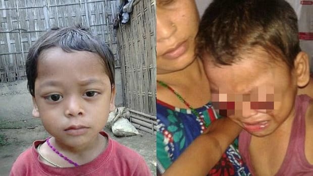 Family Asks For Help To Treat Boy Bleeding From Eyes Promo Image