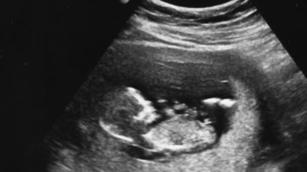Jilted Ex Pranks Man With Ultrasound Pic On Twitter  Promo Image