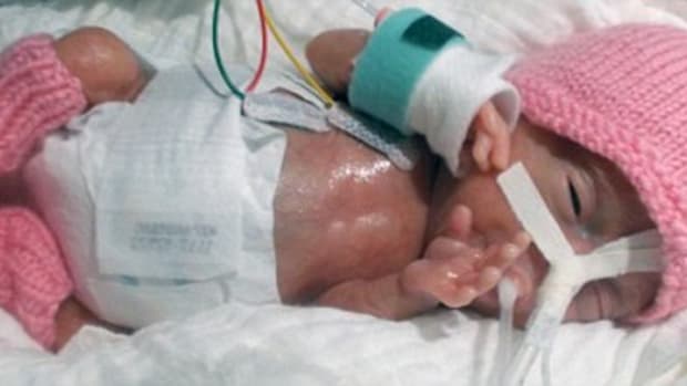 Tiniest Baby In The World Is Now Thriving (Photos) Promo Image