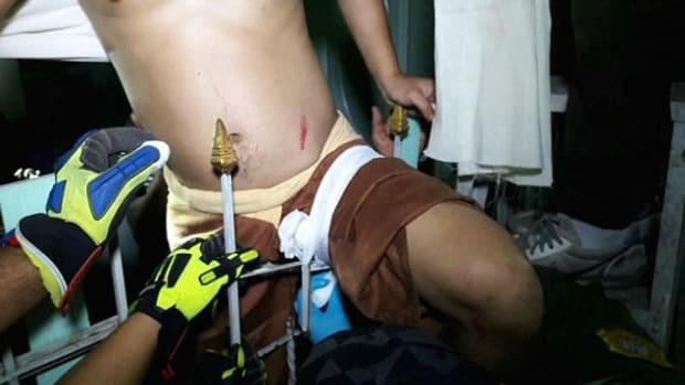 Thai Man Impaled In The Groin By Metal Spike (Photos) Promo Image