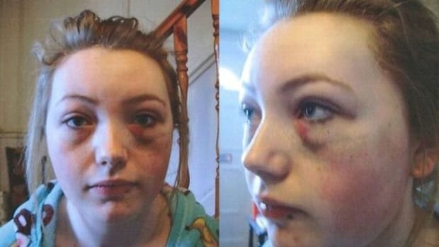 Bullying Victim's Mom: I'm Not At All Sorry For What I Did To My Daughter's Bullies (Photos) Promo Image