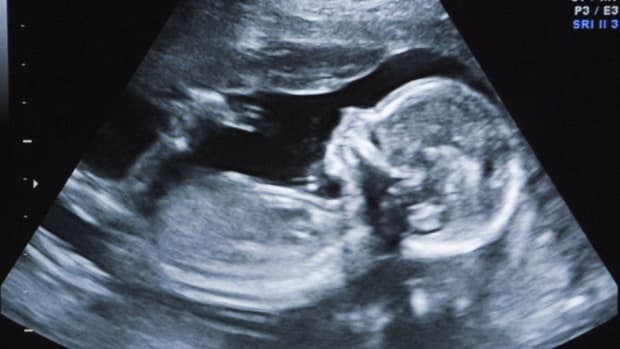 Ultrasound Reveals Baby's Legs Hanging From Womb (Photo) Promo Image