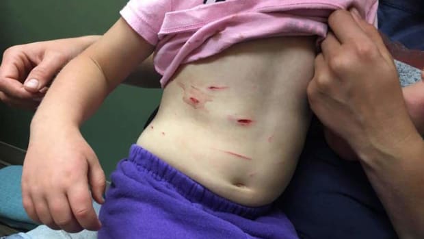 4-Year-Old Girl Dragged Away By Mountain Lion Promo Image