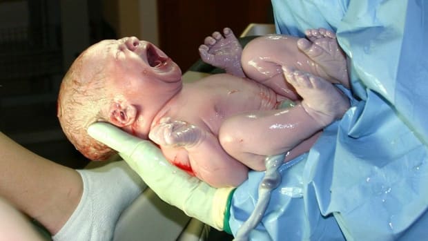 Baby Takes First Steps Minutes After Birth (Video) Promo Image