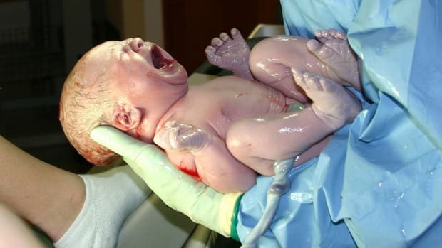 baby stuns midwife after walking