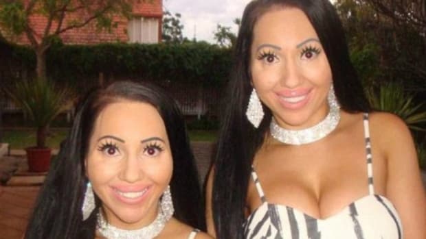 Sisters Regret Having Plastic Surgery To Look Identical Promo Image