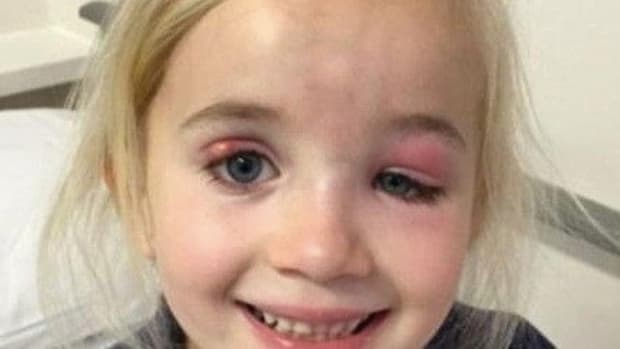 Doctors Fail To Realize What's Wrong With 5-Year-Old Girl's Eyes Until It's Too Late Promo Image
