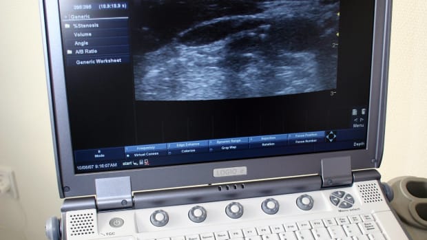 Couple Says Sonogram Shows Jesus Watching Over Fetus (Photos) Promo Image