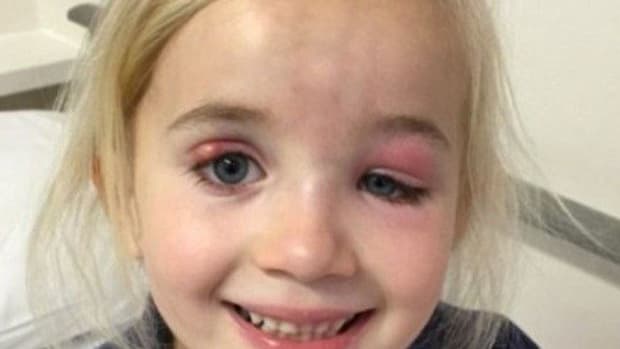 Doctors Fail To Realize What's Wrong With 5-Year-Old Eyes Until It's Too Late Promo Image