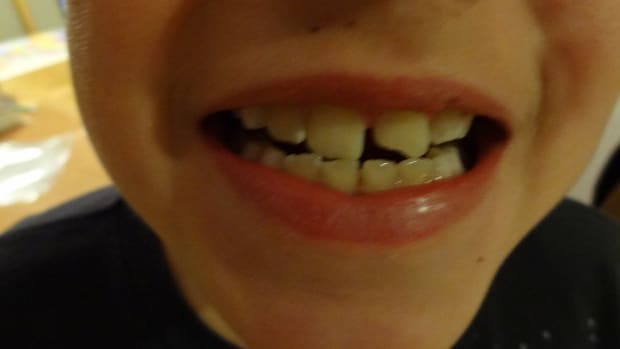 Mom Arrested For Pulling Son's Teeth At Walmart Promo Image