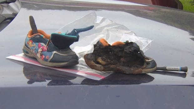 Parents Suspect Light-Up Shoes Caused Fire Promo Image