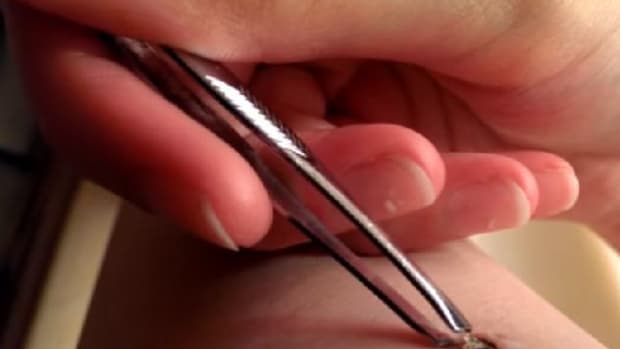 Woman Uses Pair Of Tweezers To Uncover What Had Been Causing Her Leg Pain (Video) Promo Image