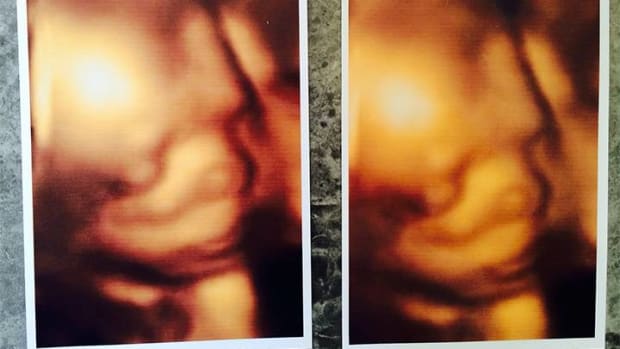 Mothers Allegedly Given Identical 3D Ultrasound Images Promo Image