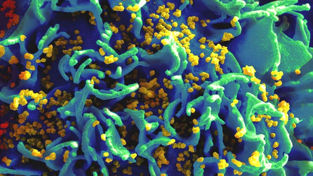 Report: New Treatment Rids Monkeys Of HIV-Like Virus Promo Image