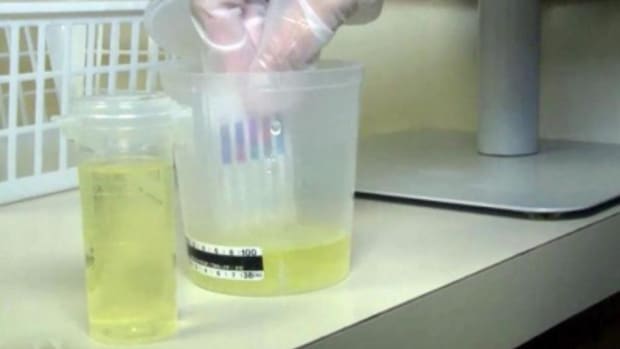 drug test urine sample