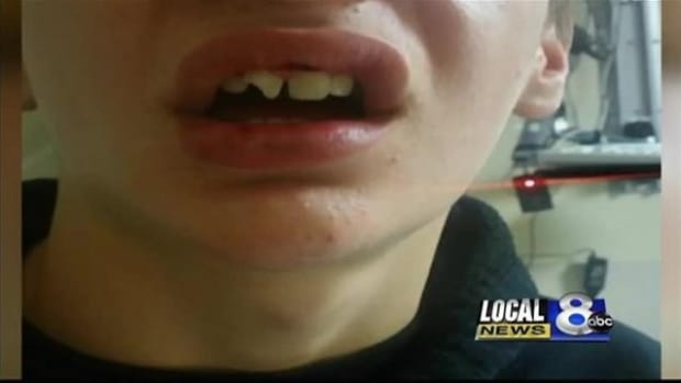 Mom Claims Officer Assaulted 12-Year-Old Son Promo Image