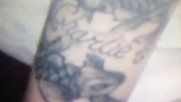 Woman's Tattoo Removal Warning Goes Viral
