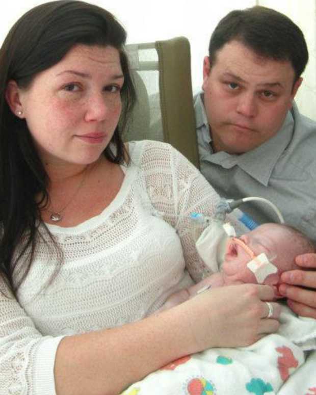 Man Almost Dies From Eating Cherries Opposing Views