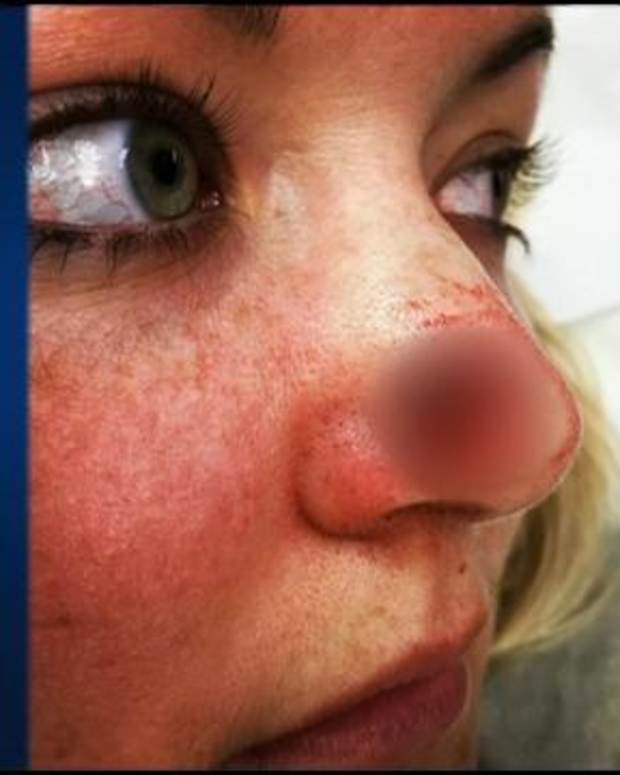 Infographic How To Check Yourself For Skin Cancer Opposing Views