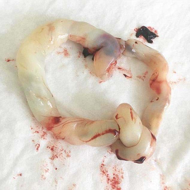 Image placeholder title