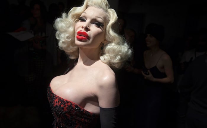 Model Amanda Lepore has opened up about her numerous plastic surgeries afte...